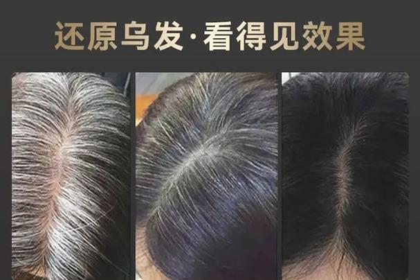 白发养黑发最好的方法