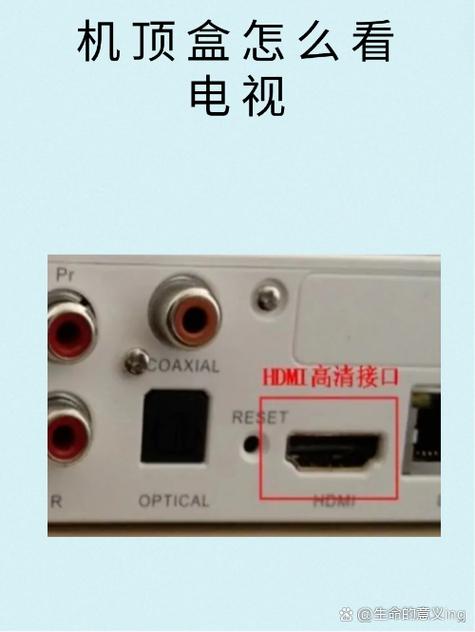 机顶盒如何把有线改为无线