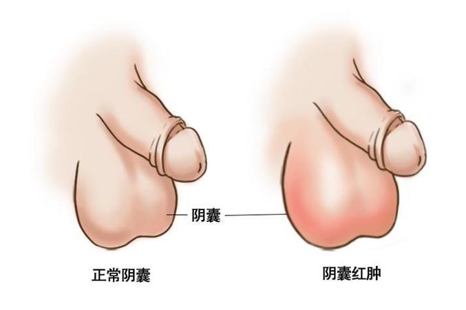 正常睾丸