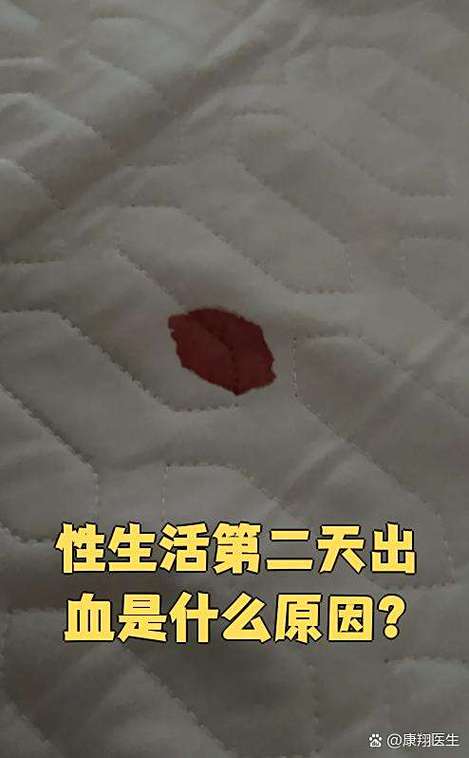 爱爱后发现月经来了怎么办