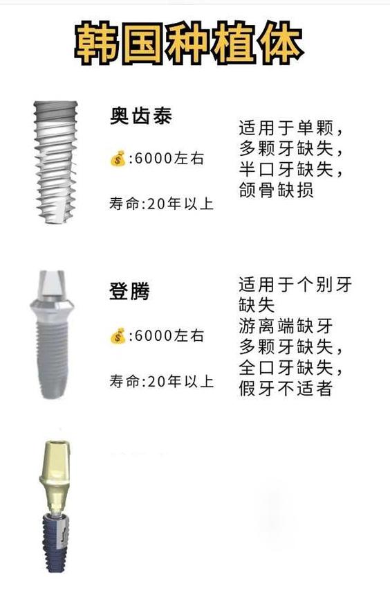 种植牙能管用多少年