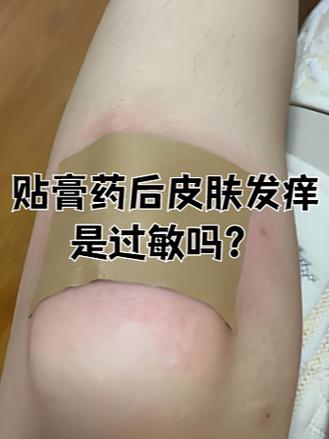 膏药粘不住老掉怎么办