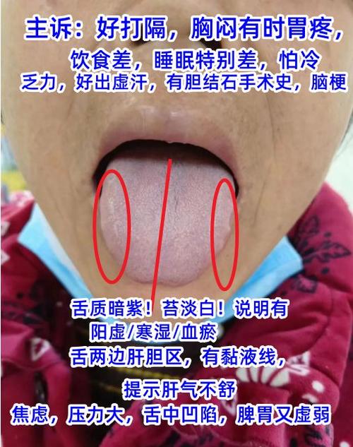 气虚可以自愈吗