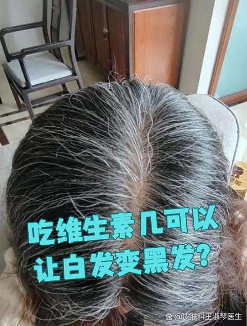头发白了吃什么变黑最快最好