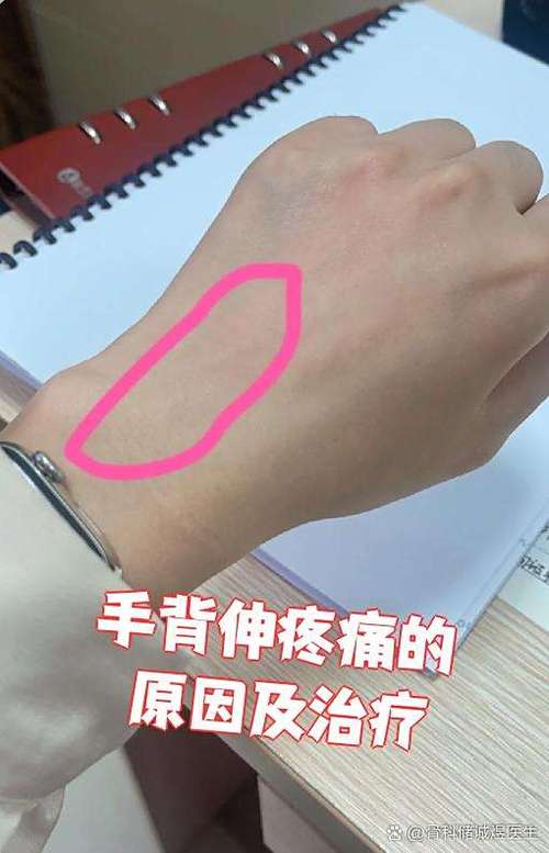 手背里面隐隐作痛什么原因