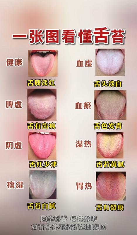拍个舌头的照片就能看病吗