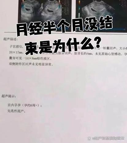 45岁月经来了半个月不走怎么回事