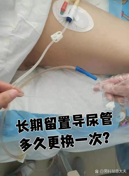 男生导管一般多久才正常