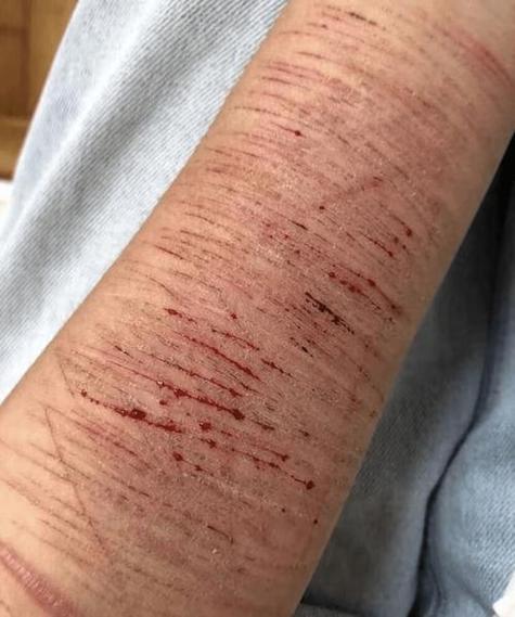 初中生用刀划手是什么心理