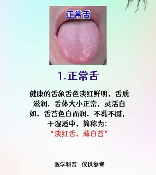 赤舌是什么原因引起的