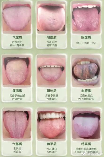 网上看舌诊准确吗