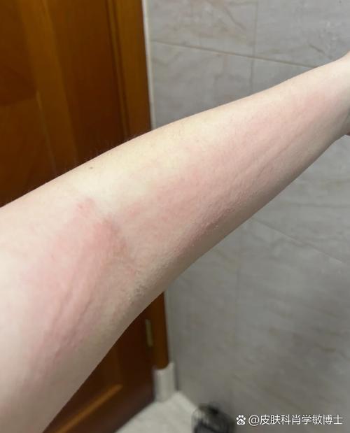 为什么洗完澡用手一搓还有泥