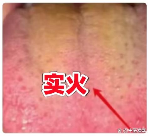 对方说上火了幽默回复