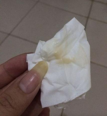 持续半个月有褐色分泌物和血