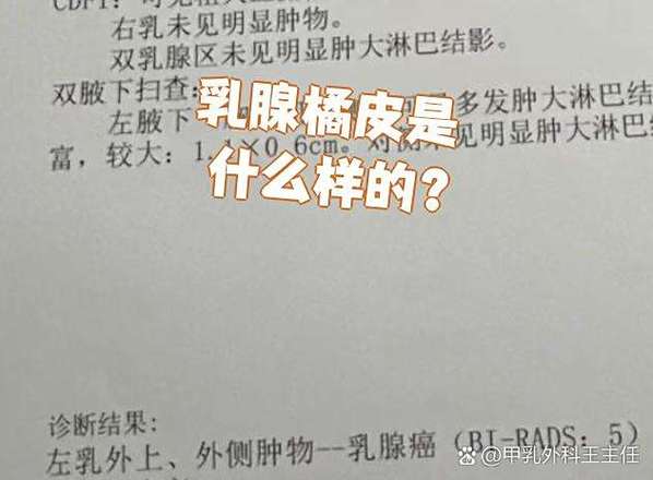 乳腺癌患者可以吃橘子吗