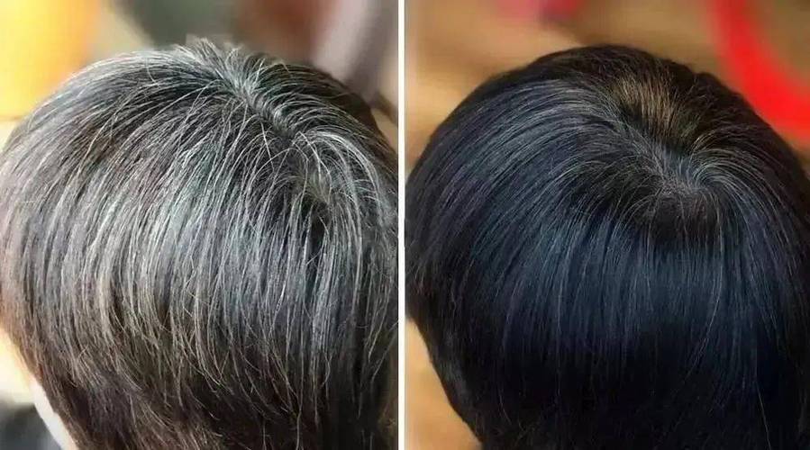 白头发变黑发实用方法