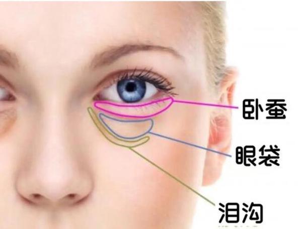 眼袋大是什么原因