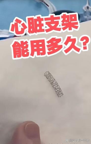 一个支架的寿命是多少年