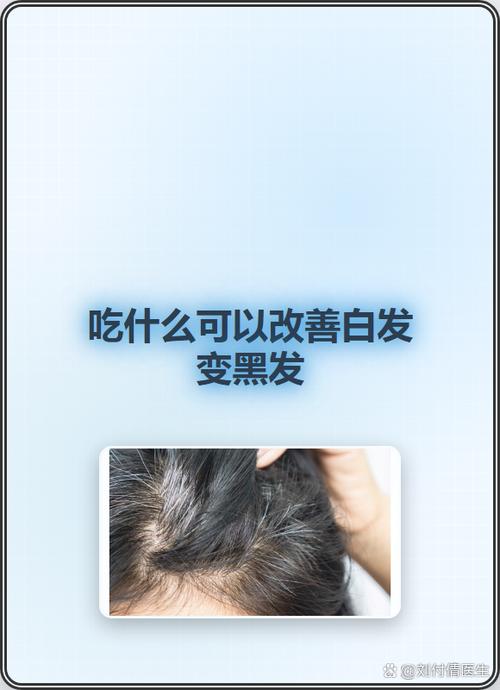 白发吃什么能变黑发
