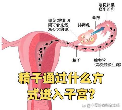 怎样加速精子进去子宫