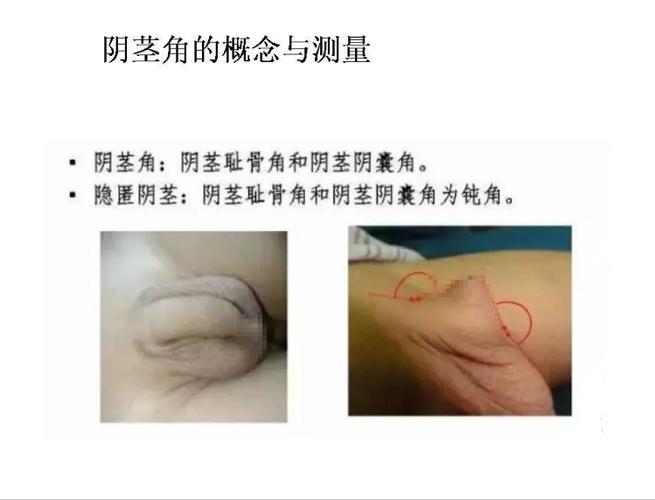 vivo手机隐藏应用图标