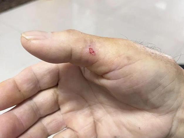 怎么看的出来被仓鼠咬到的