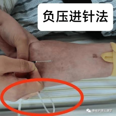 上古卷轴5血量上限减少