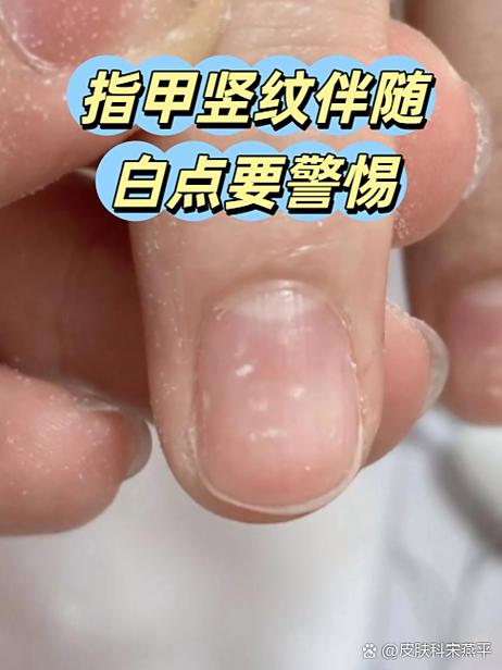手机竖纹修复小妙招