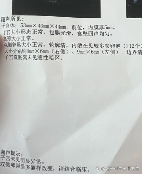 例假来了14天还没有完