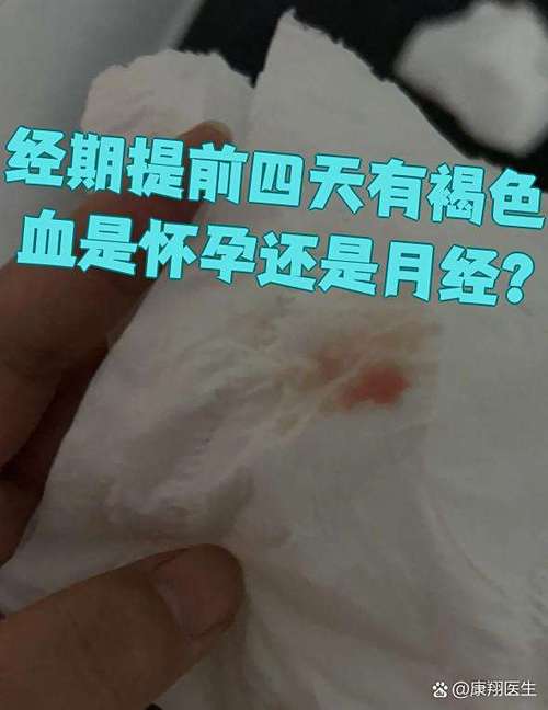 褐色血以为月经来了却怀孕了