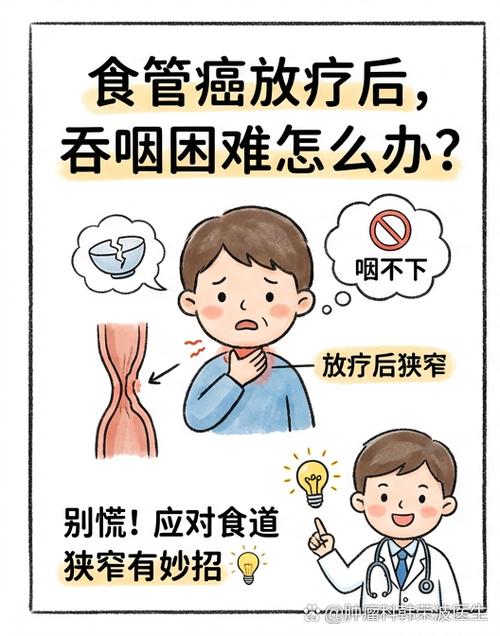 食道肿瘤最佳治疗方法