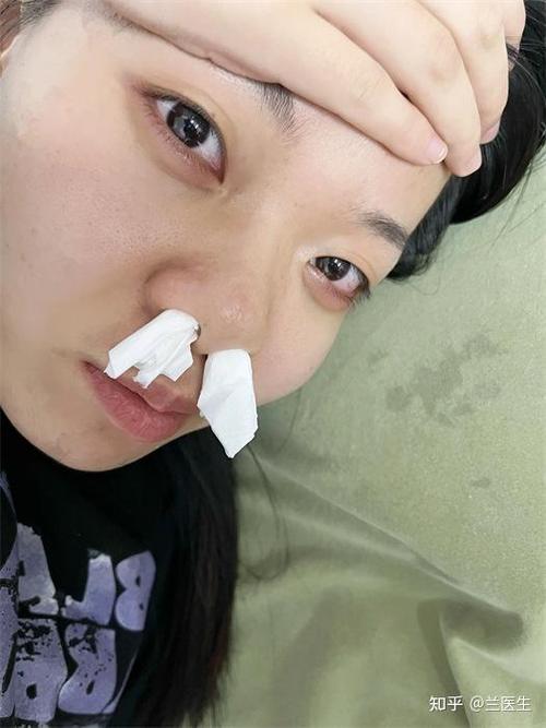 女生说流鼻涕怎么回复她