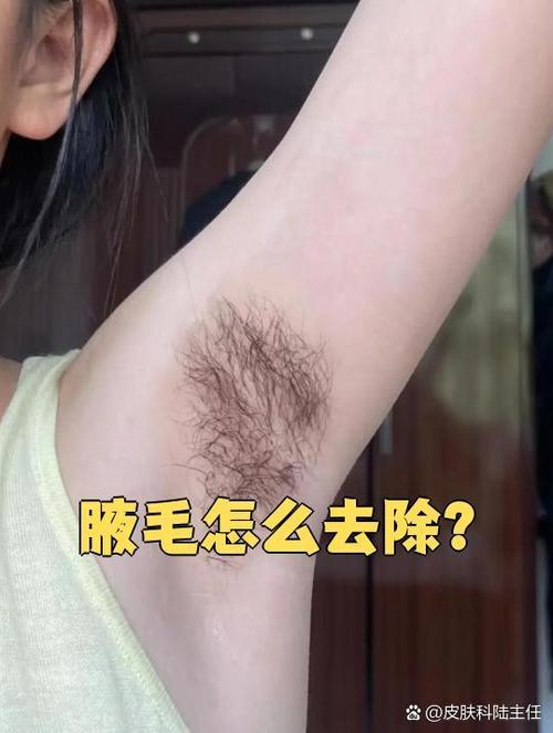 腋下的毛怎么永久去除