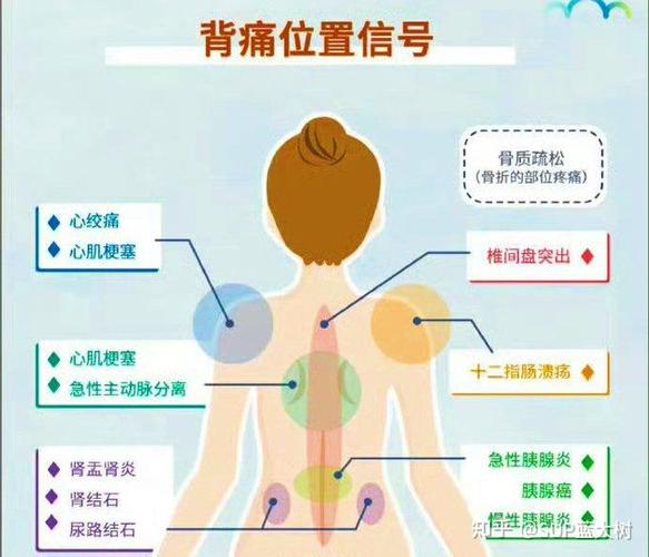 后右背疼痛要警惕的三种病症