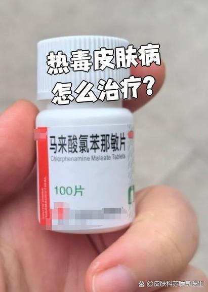 热毒皮肤病怎么治疗