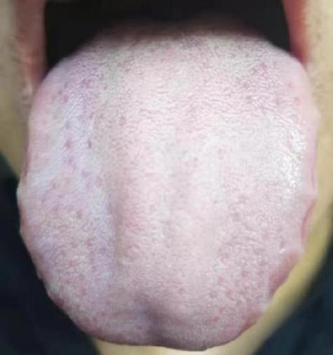 辅世国医馆看舌头开药吗
