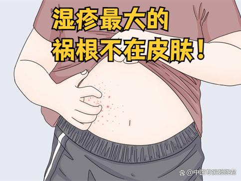 农村三个老偏方湿疹