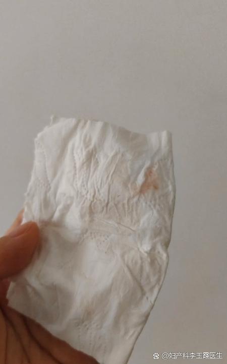 同房后擦纸上发现来月经