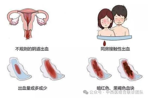 女人闭经前的5大症状