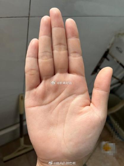 手机调高照片清晰度