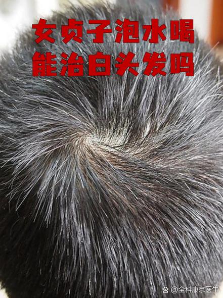 治白头发吃什么药最好最有效