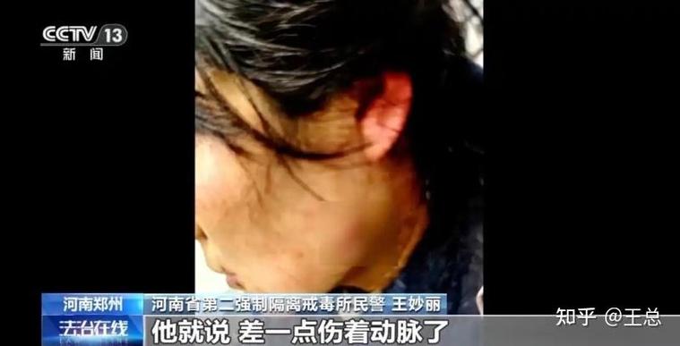 歹徒打昏女警