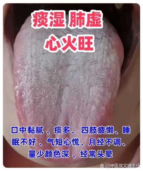 女人气虚是什么原因造成的