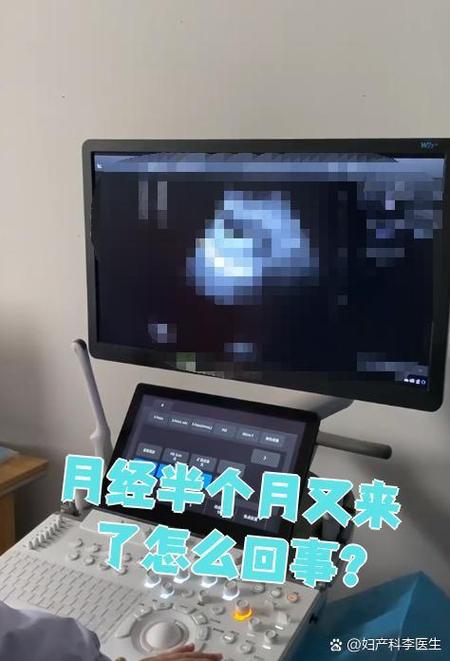 隔半个月又来月经是怎么回事