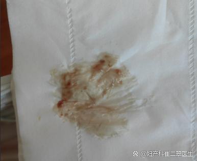 褐色的血又不像月经是怎么回事