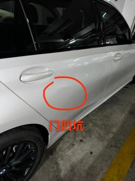 凹陷修复多少钱一个坑