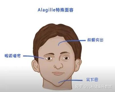 下巴遗传父亲还是母亲