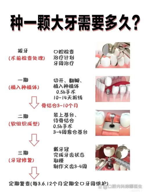 种植牙的护理方法