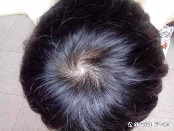 右额头有旋的男孩命运
