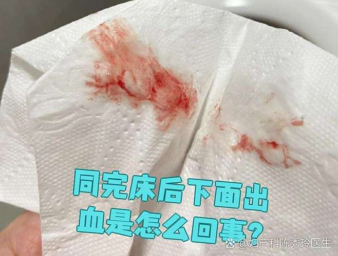 同房后出了一点血正常吗